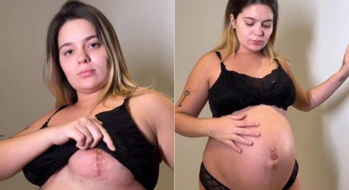 viih-tube-faz-tour-pelo-corpo-e-mostra-cicatrizes-por-consequencia-da-gravidez-31032023132555497-1-768x418