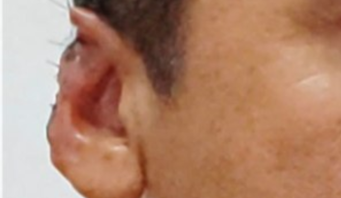 homem-corta-orelha-d24am-768x447