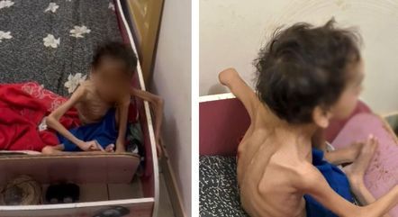 policia-prende-pais-suspeitos-de-abandonarem-filho-de-7-anos-encontrado-com-grave-de-desnutricao-14112023144031279