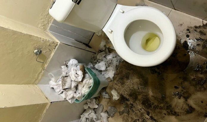 B (1)