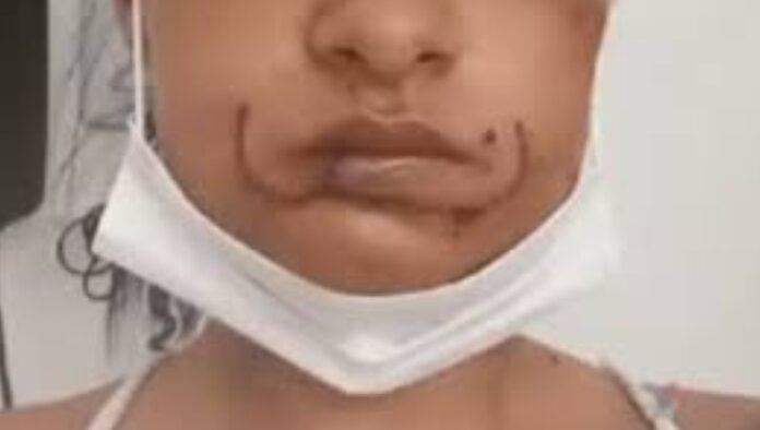 a