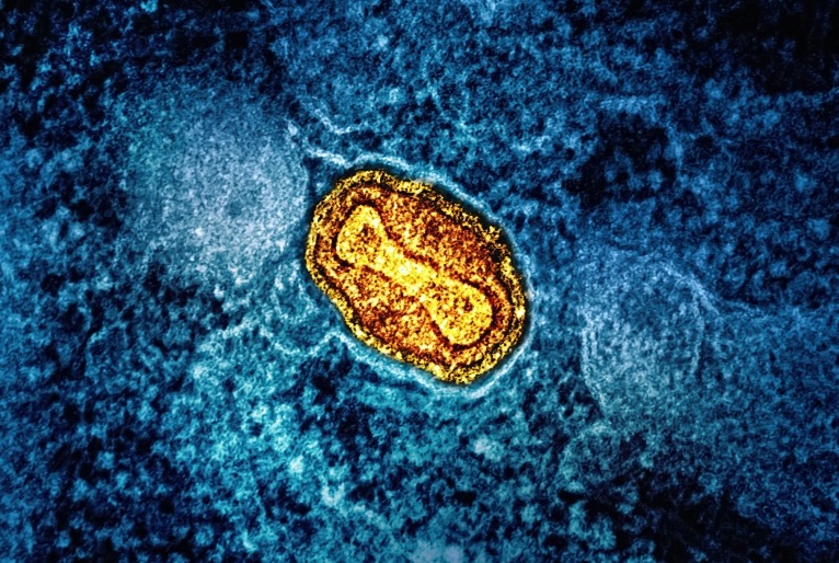 20240814150313_national-institute-of-allergy-and-infectious-diseases-ctqjqnqxny8-unsplash-1-