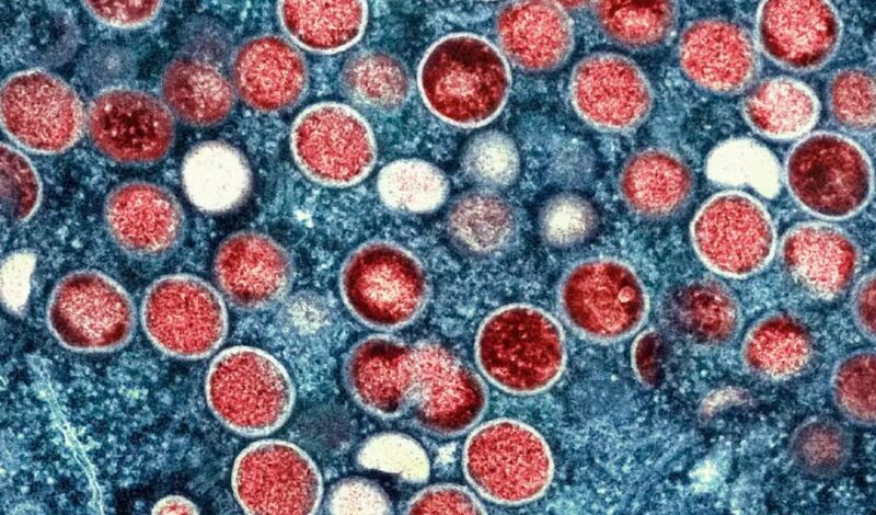 MONKEYPOX (2)