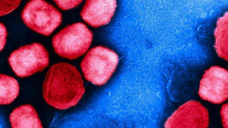 mpox