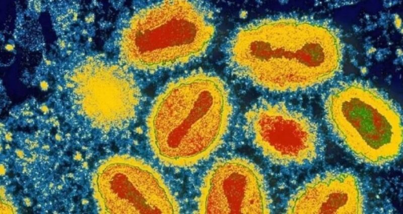 variola-dos-macacos-monkeypox-niaid-1-910x484