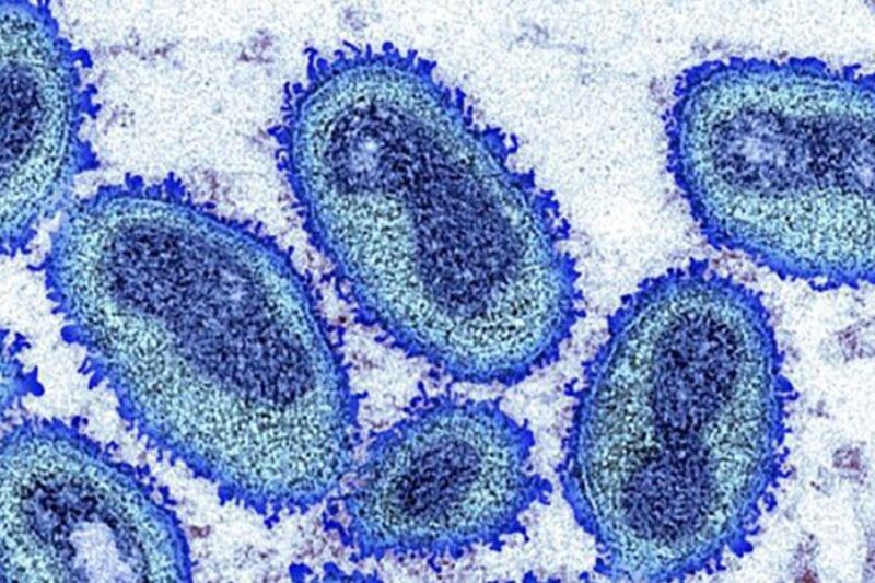 O vírus monkeypox foi descoberto em macacos em 1958 e infectou humanos em 1970 foto CDC