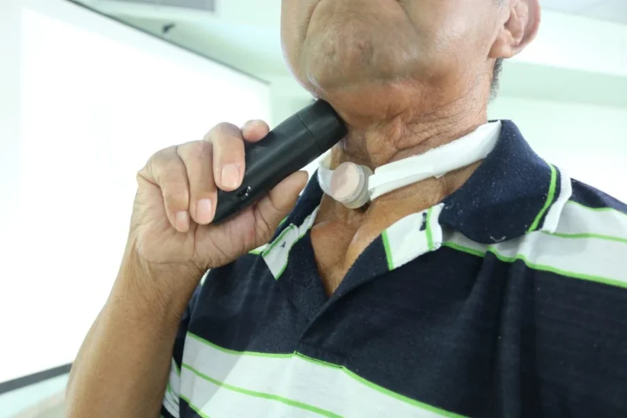 Laringes eletrônicas doam esperança e voz a pacientes com câncer de laringe na FCecon
