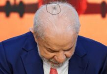 Tratando câncer de pele, Lula brinca e diz que quer ficar ainda mais “bonitão”