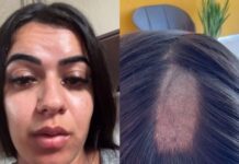 Mulher denuncia clínica após ter cabelo raspado em exame toxicológico para renovação da CNH