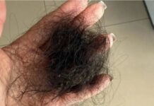 Mulher é espancada e tem parte do cabelo arrancado por dívida em compras de roupas
