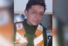 Linha de papagaio atinge rosto de mototaxista e deixa trabalhador ferido no AM