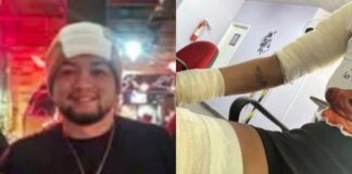 Ex-companheiro é preso após espancar mulher e provocar queimaduras com faca quente em Manaus