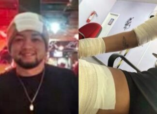 Ex-companheiro é preso após espancar mulher e provocar queimaduras com faca quente em Manaus