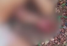 Com f3riment0 na cabeça, homem é encontrado desacordado e levado às pressas para hospital em Maués