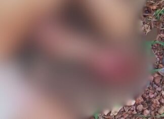 Com f3riment0 na cabeça, homem é encontrado desacordado e levado às pressas para hospital em Maués Com f3riment0 na cabeça, homem é encontrado desacordado e levado às pressas para hospital em Maués