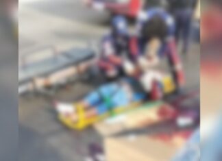 Atropelamento deixa homem gravemente ferido durante travessia na Constantino Nery, em Manaus